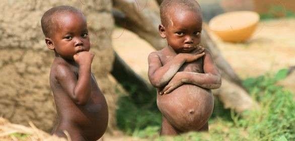 Undernourished Children