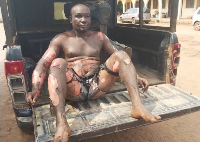 Graphic Photo: Mysterious son stabs mother, sets self ablaze in Imo