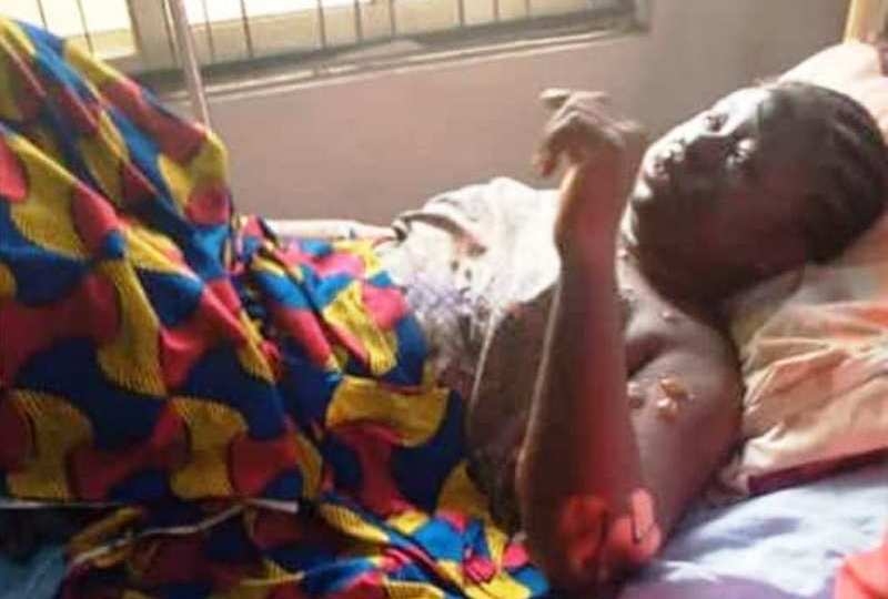 DISTURBING PHOTOS: Woman dies from severe burnt after making call close to cooking gas