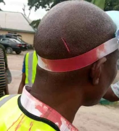 Delta: Hoodlums in COVID-19 ravaged LGA beat, inflict injuries on task force team, police officials [Graphic Photos]
