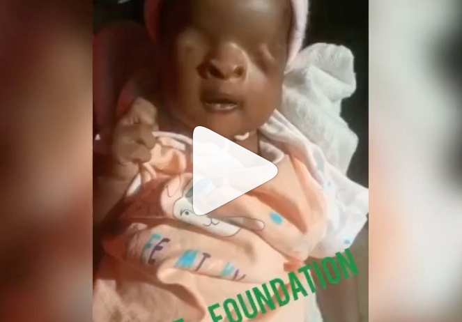 Ini Edo seeks support for baby born without eyes [VIDEO]